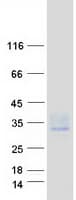 Human TSPAN15 Protein (Recombinant Myc-DDK (Flag))