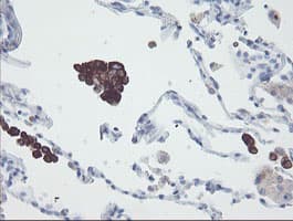 SNAI2 / SLUG Antibody (clone OTI16G7)