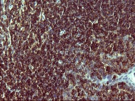 CD45 / LCA Antibody (clone OTI1B6)