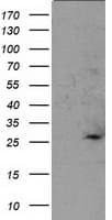 Monoclonal Mouse anti-Human SOCS3 Antibody (clone OTI6F3, WB)
