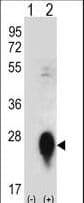 CLEC3B / Tetranectin Antibody (aa95-122)
