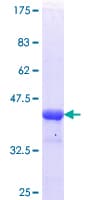 Human HDAC4 Protein (Recombinant GST, N-terminus)