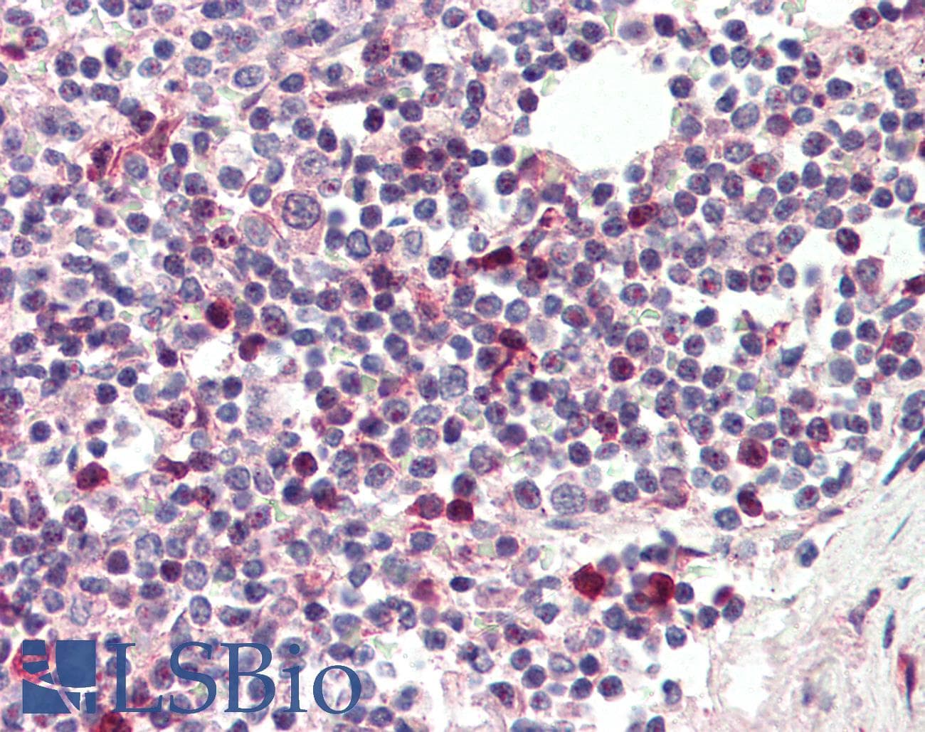 IHC-plus™ TFEC Antibody (aa217-228)