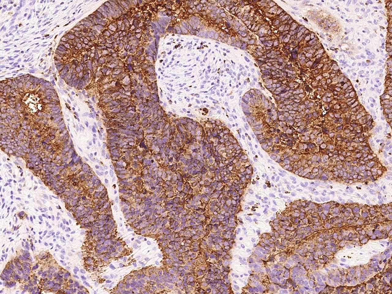 CD66c / CEACAM6 Antibody (Preservative Free)