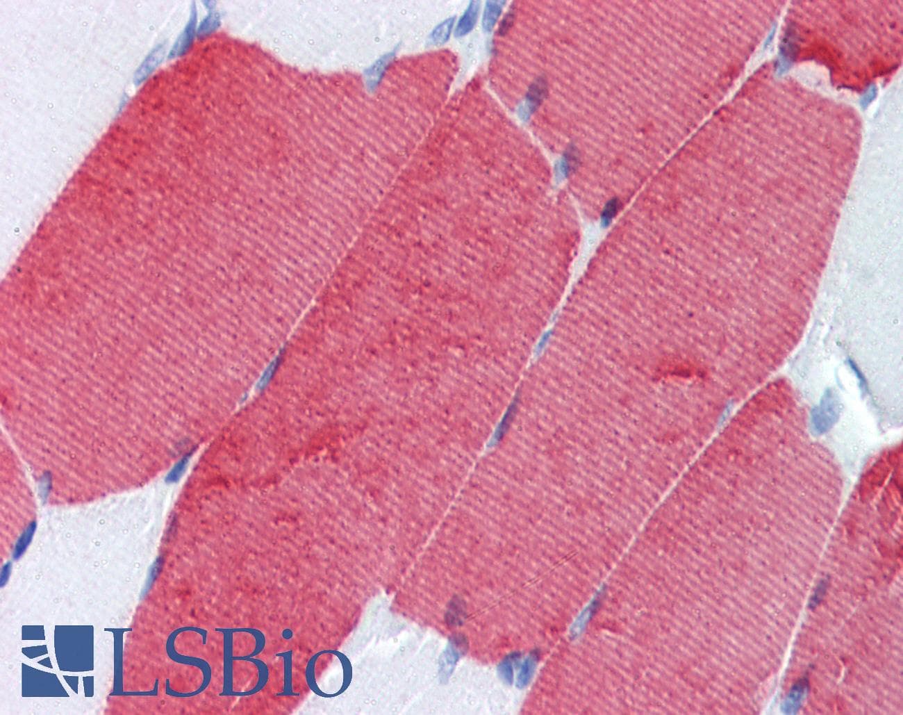 IHC-plus™ TNNT3 Antibody (clone T1/61)