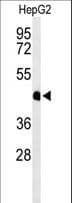 Polyclonal Rabbit anti-Human HFE2 / Hemojuvelin Antibody (aa308-338, WB)