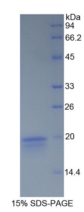 Rabbit IFN Gamma / Interferon Gamma Protein (Recombinant His)