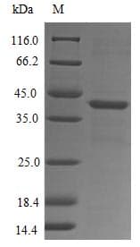 Human FPR1 / FPR Protein (Recombinant 10His-GST, N-terminus + Myc, C-terminus)
