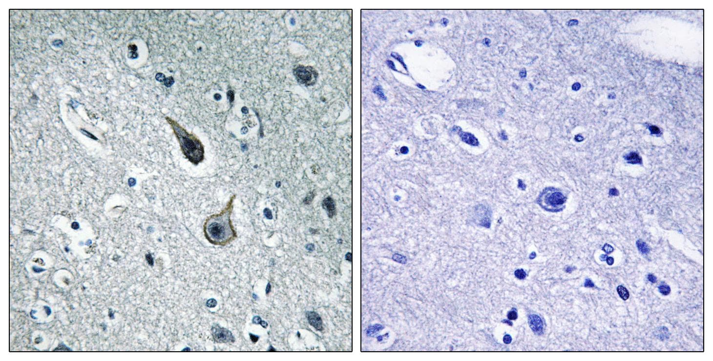 HTR2A / 5-HT2A Receptor Antibody