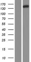 NRDE2 / C14orf102 Protein (Over-Expression Lysate Myc-DDK (Flag))