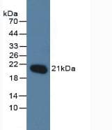 MGMT Antibody (aa1-207, APC)