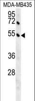 GKAP1 Antibody (aa331-359)