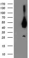 Monoclonal Mouse anti-Human ASCC1 Antibody (clone OTI1H10, WB)