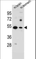 IHC-plus™ Polyclonal Rabbit anti-Human SLC16A11 Antibody (aa48-76, IHC, WB)