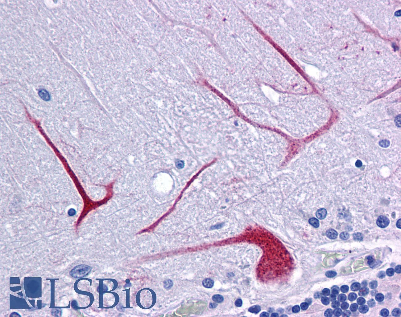 IHC-plus™ BANP Antibody
