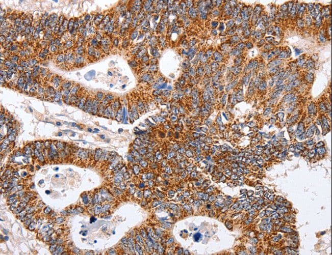MAP2K5 / MEK5 Antibody