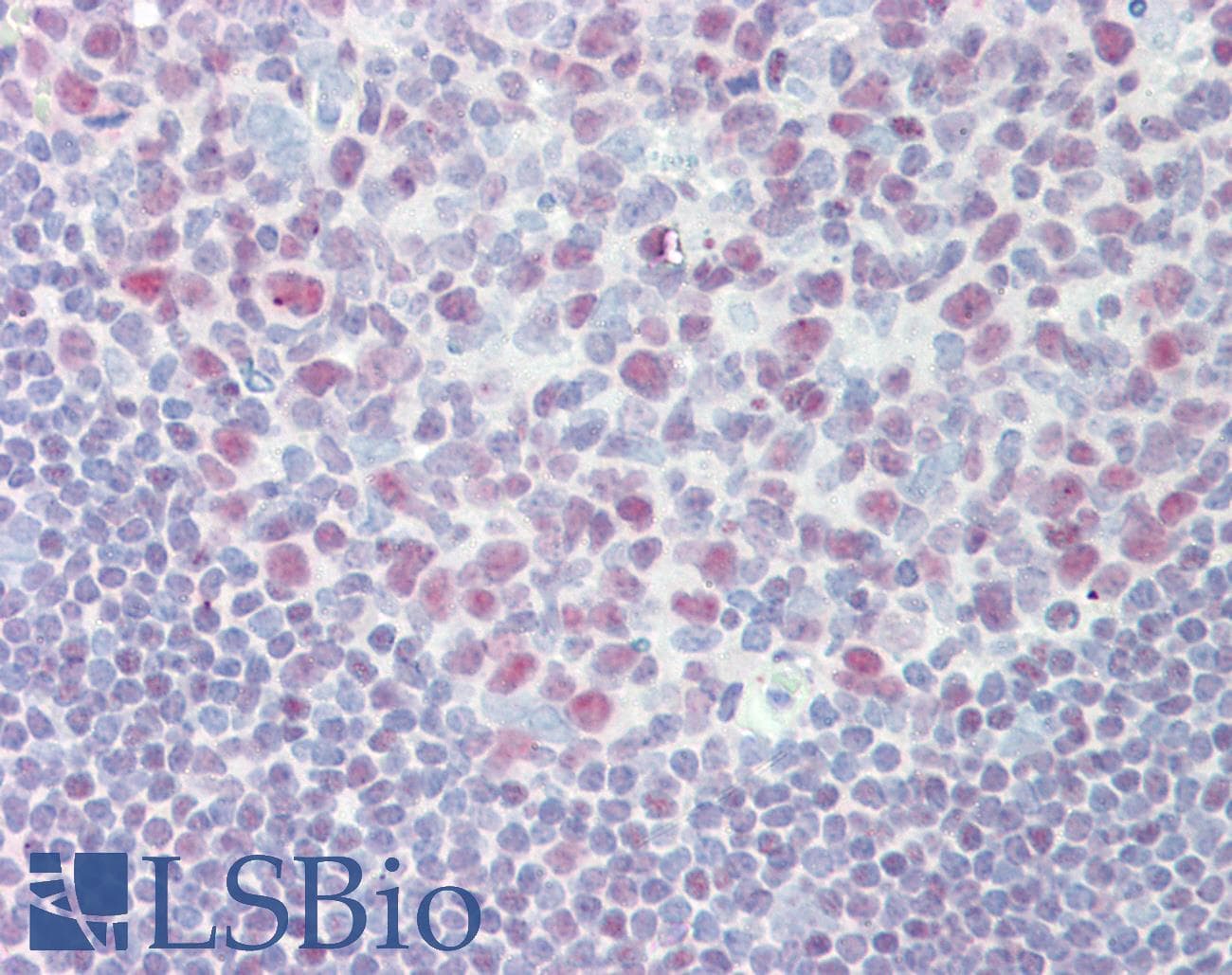 Polyclonal Rabbit anti-Human IKZF1 / IKAROS Antibody (aa350-399, IHC, WB)