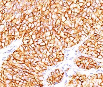 CA9 / Carbonic Anhydrase IX Antibody (clone 66.4.C2, Ready-to-Use)