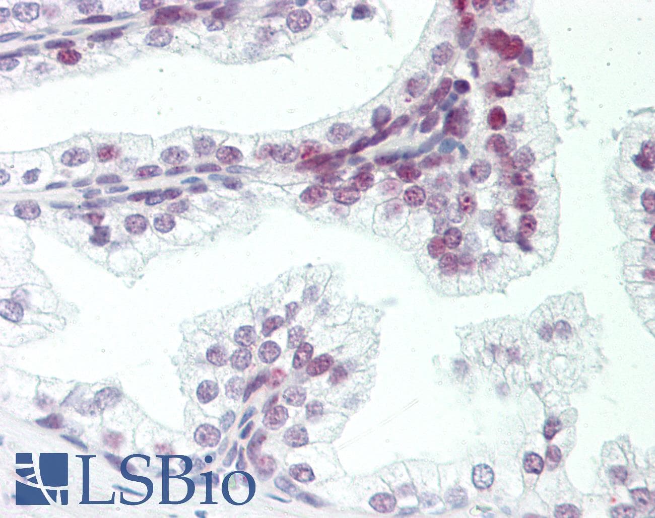 ZMYM6 Antibody (aa17-66)