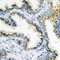 ARL6 Antibody