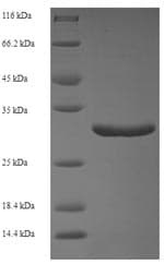 Human CALML5 Protein (Recombinant 6His-SUMO, N-terminus)