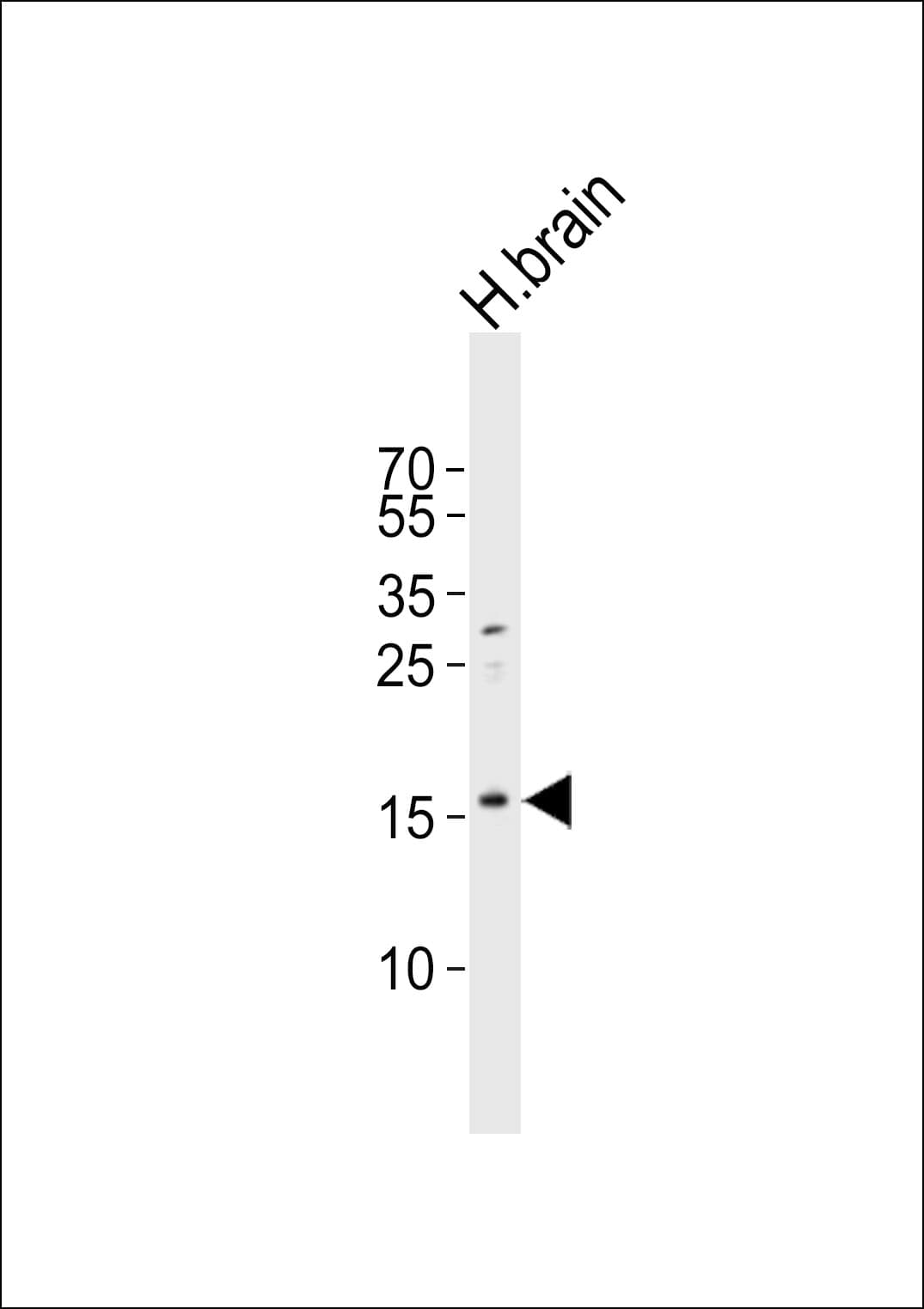 Polyclonal Rabbit anti-Human IL37 Antibody (WB)