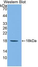 IL1F9 Antibody (aa5-149)