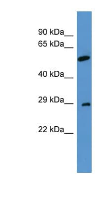 CABP4 Antibody (aa25-74)