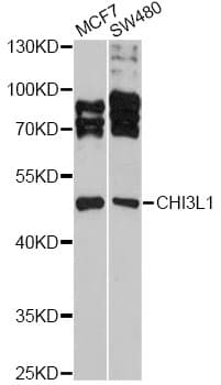 IHC-plus™ Polyclonal Rabbit anti-Human CHI3L1 / YKL-40 Antibody (IHC, WB)