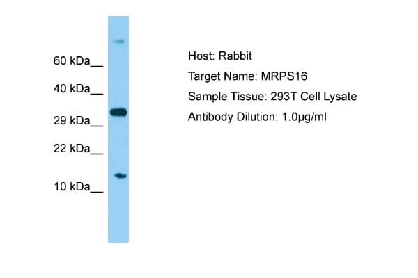 Polyclonal Rabbit anti-Human MRPS16 Antibody (C-Terminus, WB)
