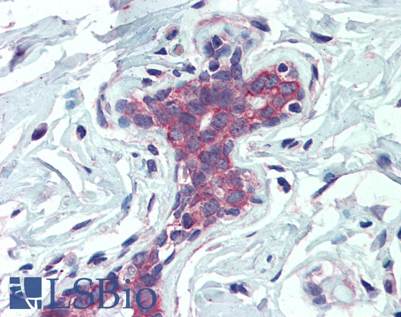 IHC-plus™ Polyclonal Goat anti-Human EPB41L2 Antibody (aa593-604, IHC, WB)
