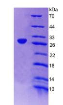 Human AMPH / Amphiphysin Protein (Recombinant His-T7)