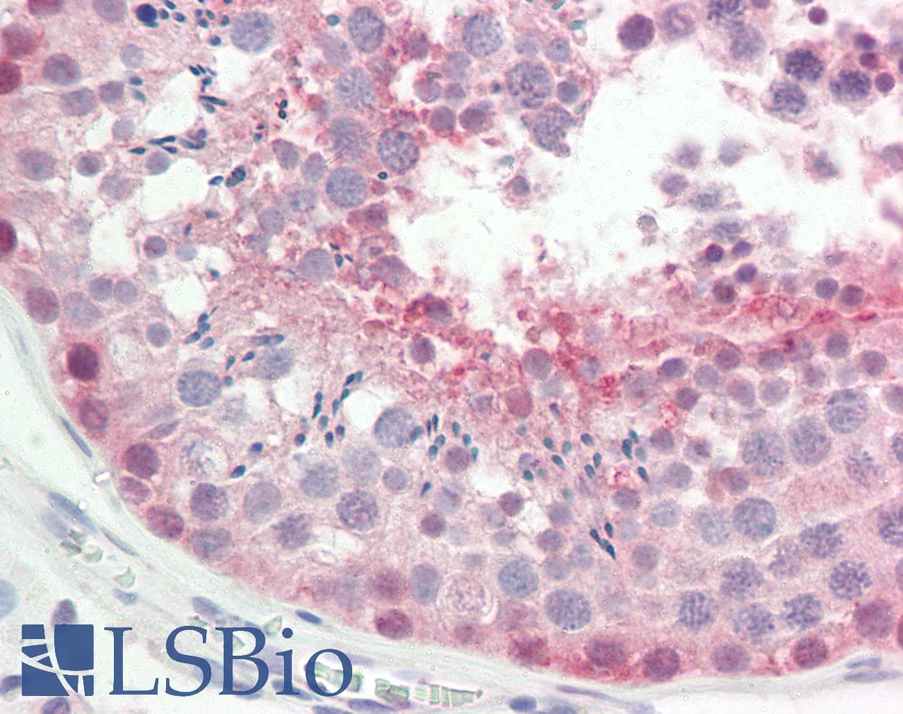IHC-plus™ ROPN1L Antibody (aa32-60)