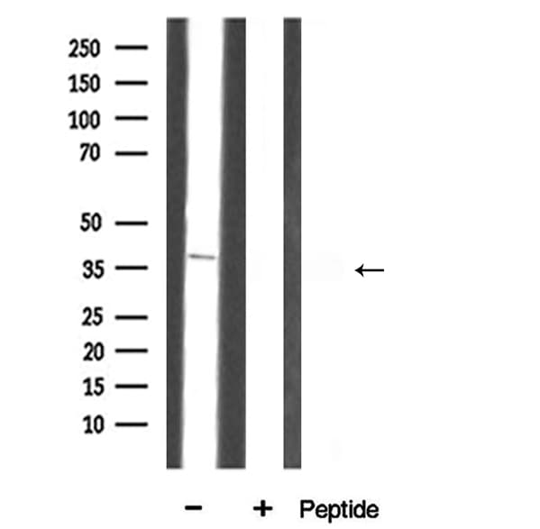 ANXA3 / Annexin A3 Antibody