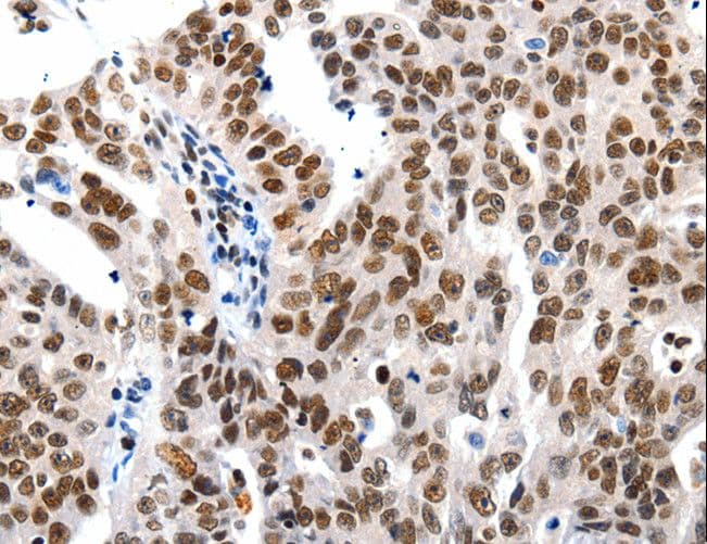 HDAC1 Antibody