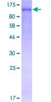 Human TRIM28 / KAP1 Protein (Recombinant GST)