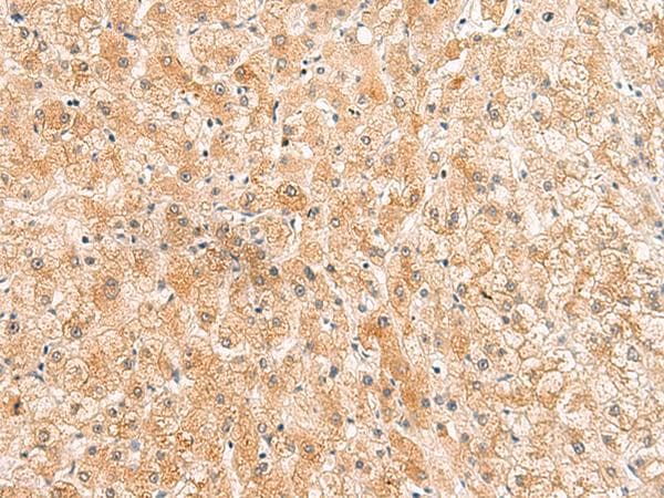 Ls31689 Antibody