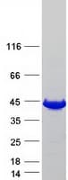 Human GMPR2 Protein (Recombinant Myc-DDK (Flag))
