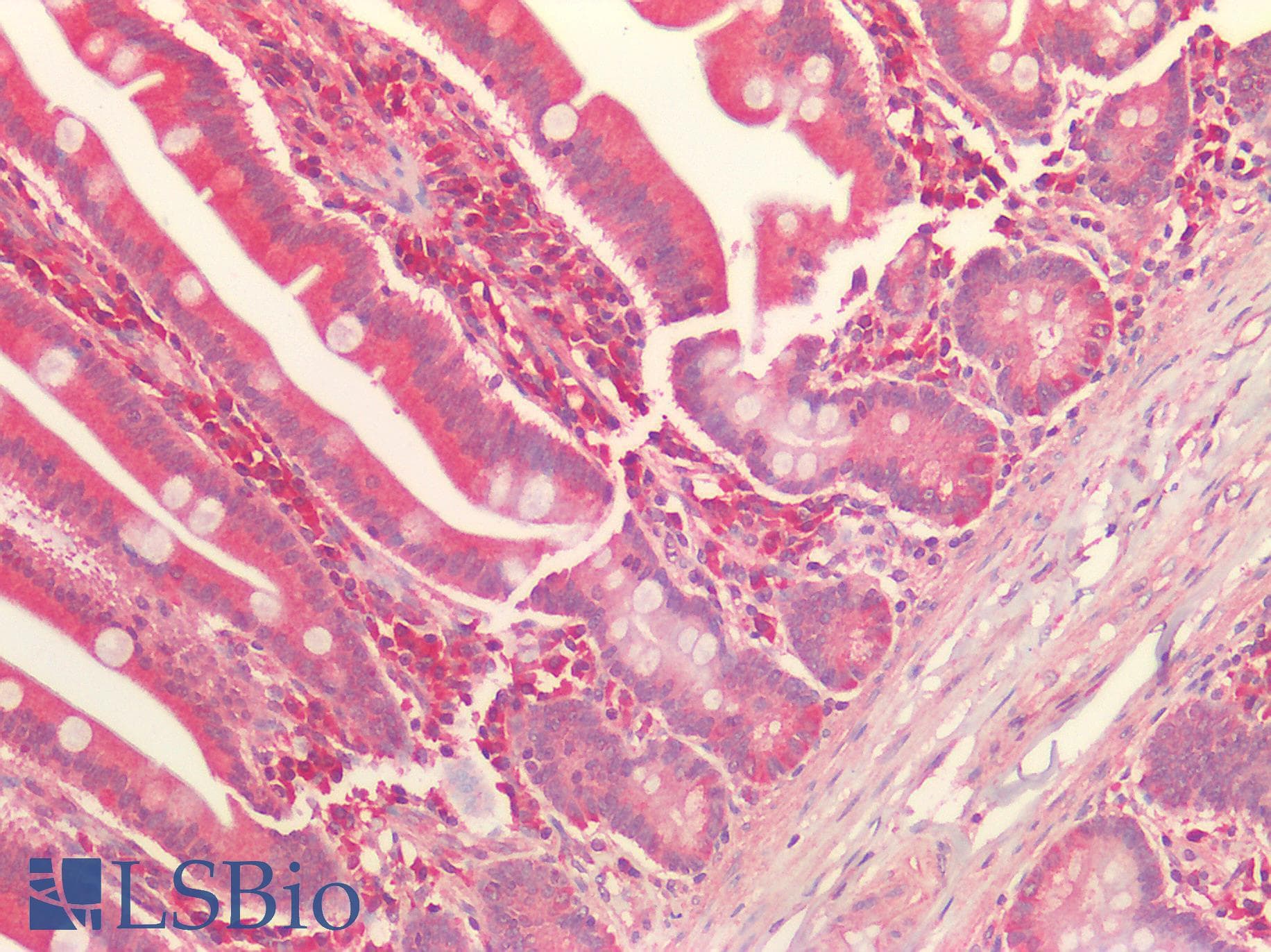 IHC-plus™ ERGIC2 Antibody (aa55-310)