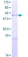 Human MTA1 Protein (Recombinant GST)
