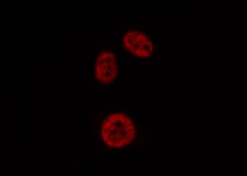 PADI4 / PAD4 Antibody
