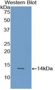 AGRP Antibody (aa20-130, APC)