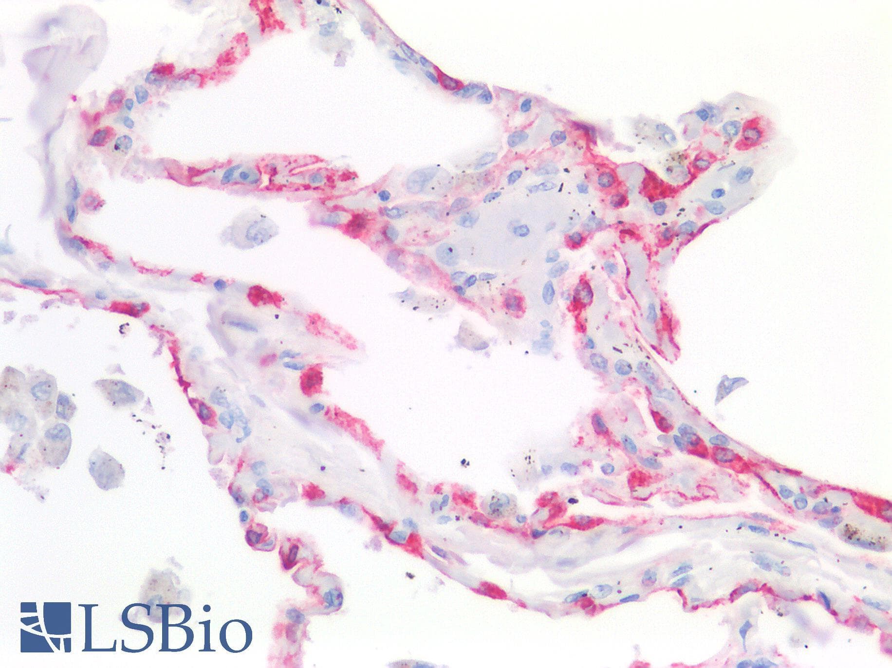 PathPlus™ Monoclonal Mouse anti-Human KRT7 / CK7 / Cytokeratin 7 Antibody (IHC, WB)