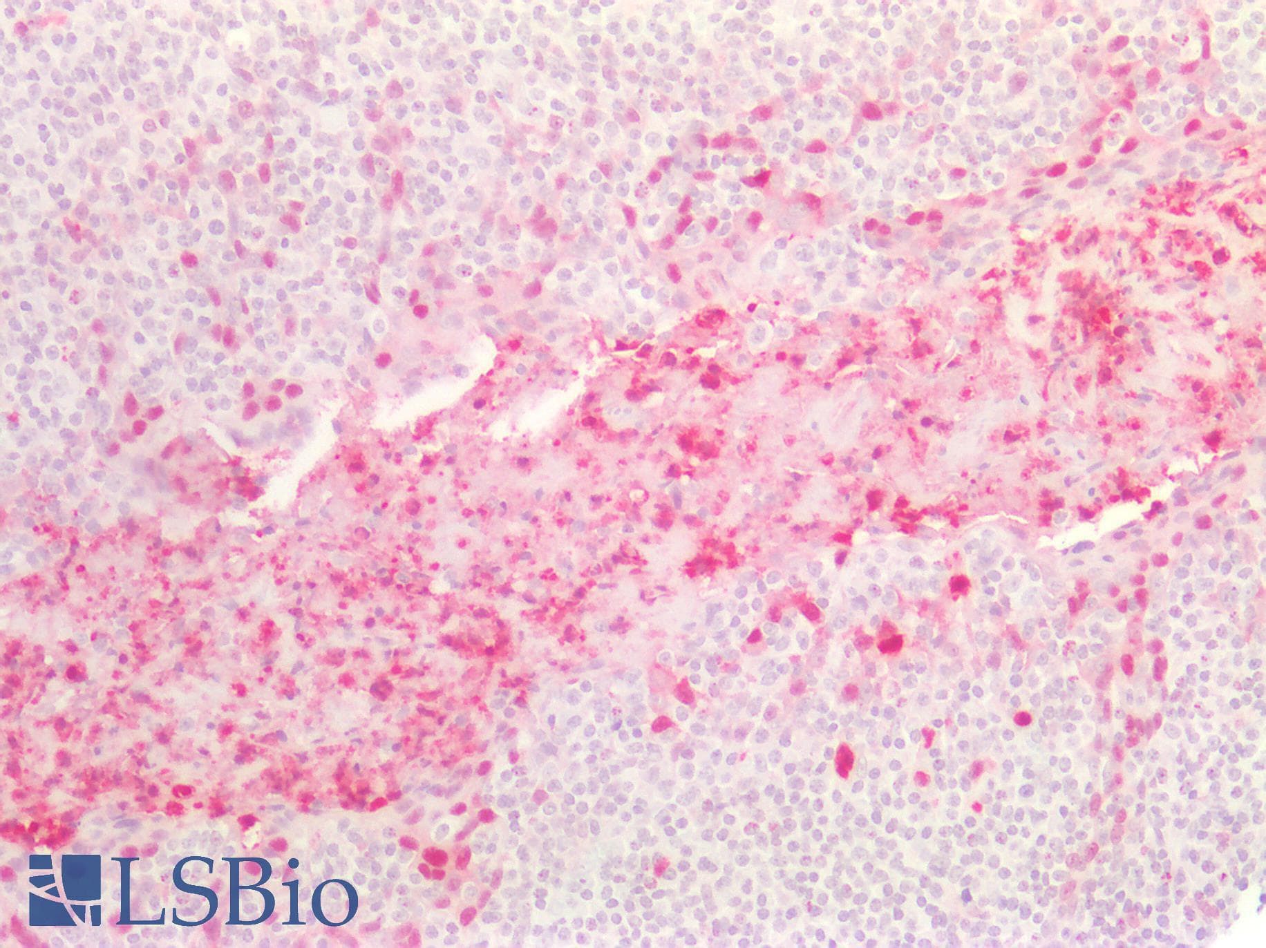 PathPlus™ Monoclonal Mouse anti-Human S100A8 / MRP8 Antibody (clone CF-145, IHC, IF, WB)