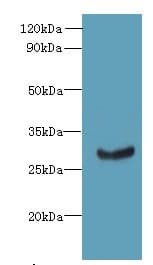 Polyclonal Rabbit anti-Human C11orf68 Antibody (IHC, WB)