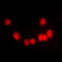 HKR1 Antibody (Internal)