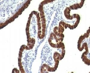 KRT7 / CK7 / Cytokeratin 7 Antibody (clone CTKN7-1)