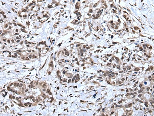 Polyclonal Rabbit anti-Human TIA-1 Antibody (IHC, WB)