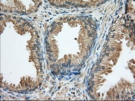 Monoclonal Mouse anti-Human RAB17 Antibody (clone OTI3A5, IHC, IF, WB)