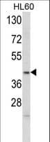 APOL4 / Apolipoprotein L 4 Antibody (aa258-290)